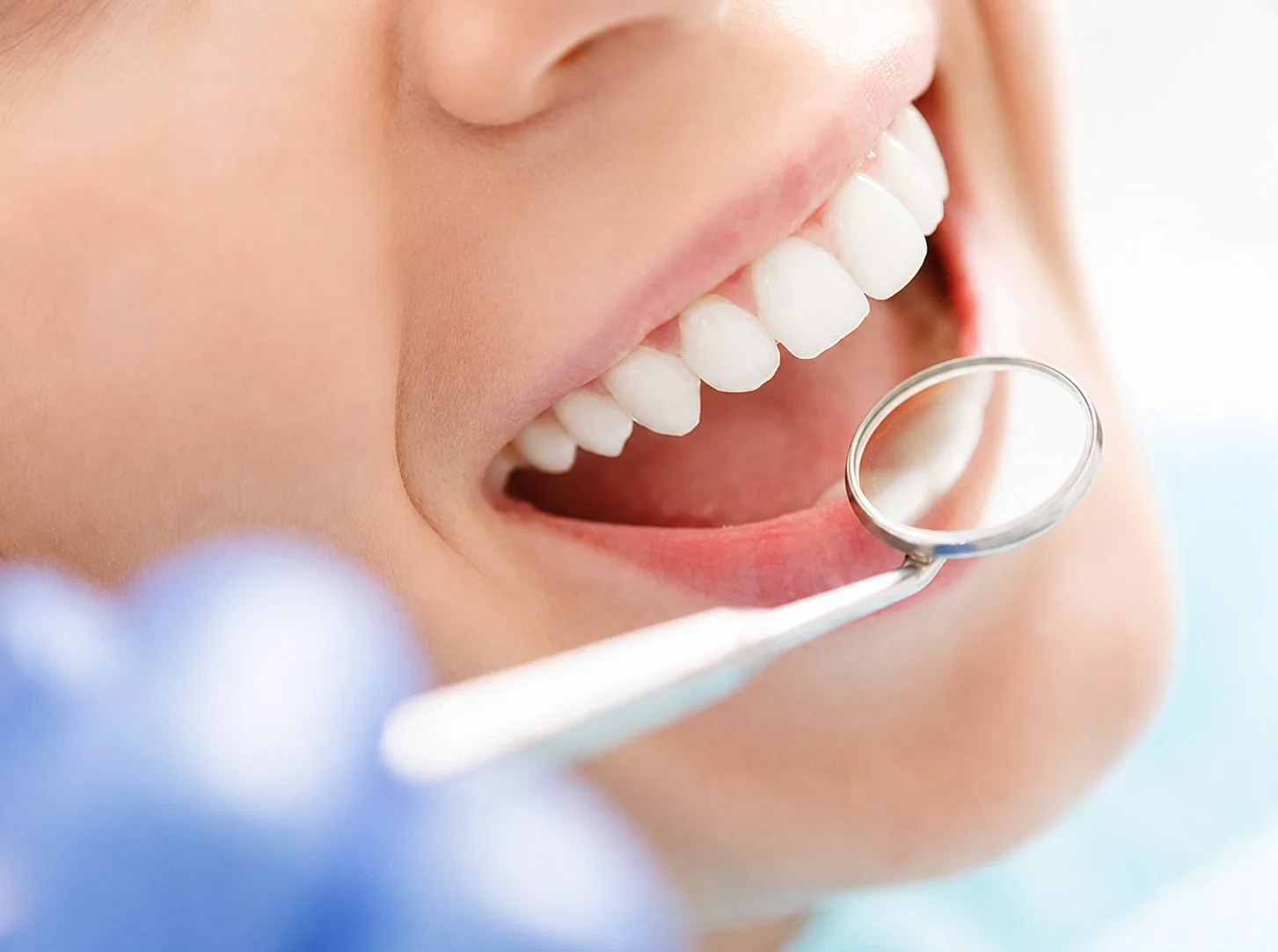 Przegląd stomatologiczny - lusterko dentystyczne przy zdrowych, białych zębach pacjentki